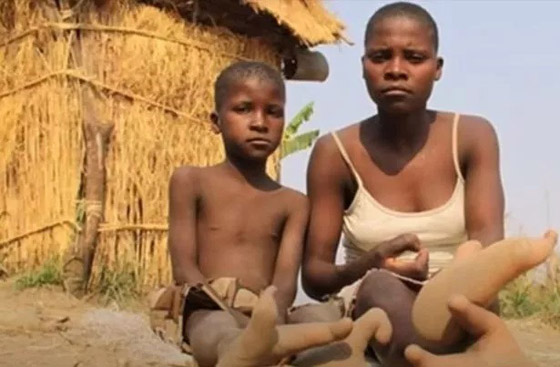 قبيلة غامضة بأقدام مشوهة تطورت لتسلق الأشجار صورة رقم 2