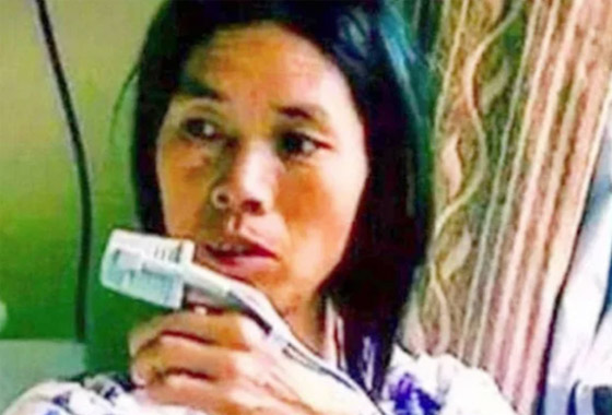 أحدهم لم ينم أكثر من 40 عاما.. أغرب 4 حالات مرضية نادرة في العالم صورة رقم 2