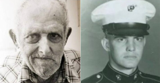 أحدهم لم ينم أكثر من 40 عاما.. أغرب 4 حالات مرضية نادرة في العالم صورة رقم 3