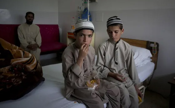 أحدهم لم ينم أكثر من 40 عاما.. أغرب 4 حالات مرضية نادرة في العالم صورة رقم 4