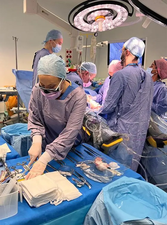 أخت تبرعت لشقيقتها.. نجاح أول عملية زراعة رحم في بريطانيا! فيديو صورة رقم 5 أخت تبرعت لشقيقتها.. نجاح أول عملية زراعة رحم في بريطانيا! فيديو صورة رقم 5