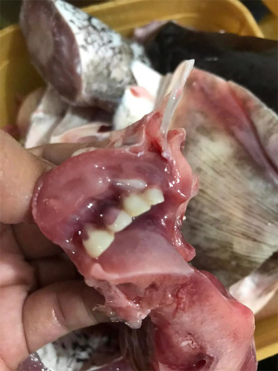 صور: فلبينية تعثر على أسنان بشرية بسمكة الغذاء! صورة رقم 3