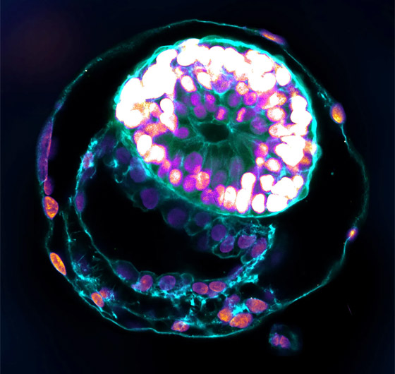 الأجنة البشرية الاصطناعية: تساؤلات أخلاقية لا تنتهي! صورة رقم 3