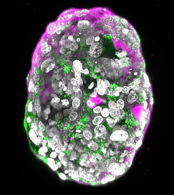 الأجنة البشرية الاصطناعية: تساؤلات أخلاقية لا تنتهي! صورة رقم 8