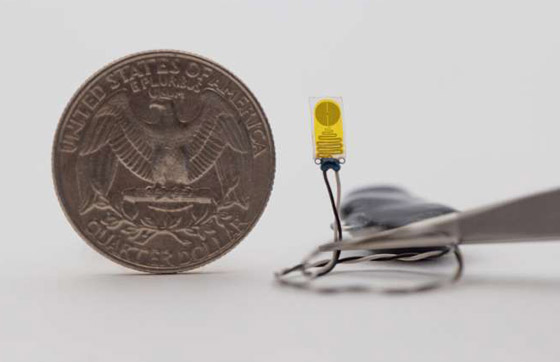 أول جهاز إنذار لمراقبة صحة الأعضاء المزروعة! صورة رقم 1