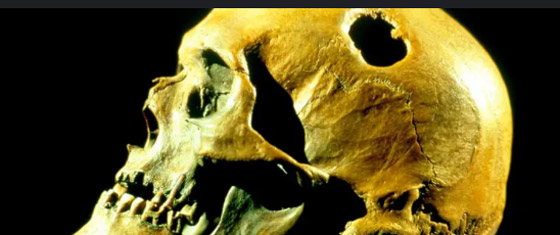 لماذا كان الإنسان القديم يثقب جمجمته؟ صورة رقم 1