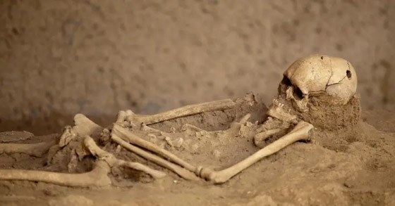 لماذا كان الإنسان القديم يثقب جمجمته؟ صورة رقم 5