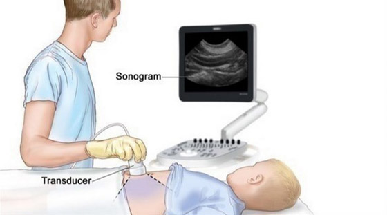 فيليبس تطلق تقنية جديدة لتشخيص السرطان بالموجات فوق الصوتية صورة رقم 3