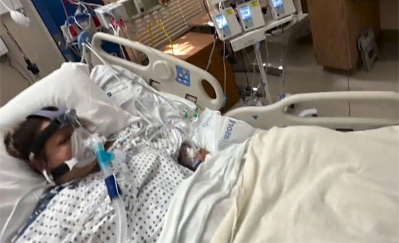 سيدة تفقد أطرافها الأربعة بعد تناولها وجبة سمك صورة رقم 4