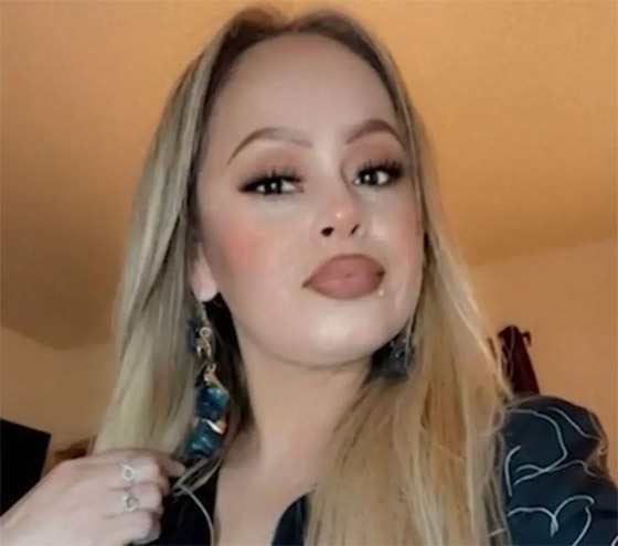 سيدة تفقد أطرافها الأربعة بعد تناولها وجبة سمك صورة رقم 6