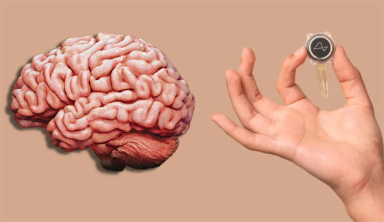 شركة إيلون ماسك ستزرع رقائق إلكترونية بالأدمغة! يبحثون عن متطوعين للتجارب صورة رقم 7 شركة إيلون ماسك ستزرع رقائق إلكترونية بالأدمغة! يبحثون عن متطوعين للتجارب صورة رقم 7