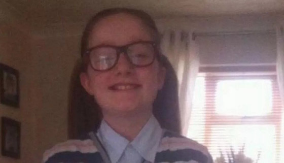 وصفها المتنمرون بالقبيحة.. فتحولت إلى عارضة حسناء صورة رقم 2