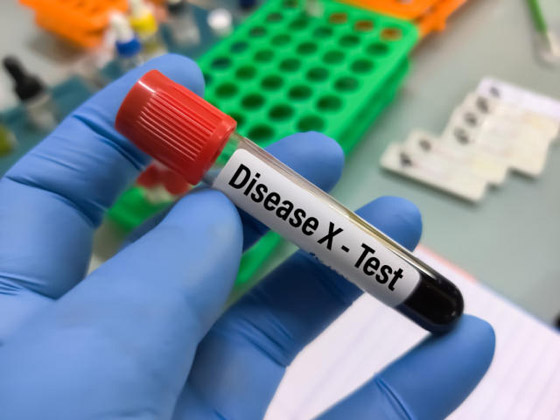 بـ6 نقاط.. ما هو المرض X وكيف يستعد العلماء للوباء الذي قد ينجم عنه بالمستقبل؟ صورة رقم 4