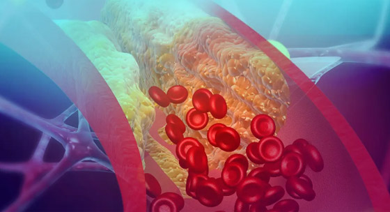 لتحسين مستويات الكولسترول وصحة القلب.. 5 تغييرات في نمط الحياة صورة رقم 5