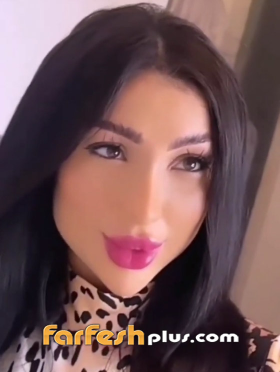 فيديو دنيا بطمة تحقن وجهها وتنفخ شفتيها وتتغزل بنفسها، والجمهور: مهووسة عمليات تجميل وشوهت شكلها! صورة رقم 3 فيديو دنيا بطمة تحقن وجهها وتنفخ شفتيها وتتغزل بنفسها، والجمهور: مهووسة عمليات تجميل وشوهت شكلها! صورة رقم 3