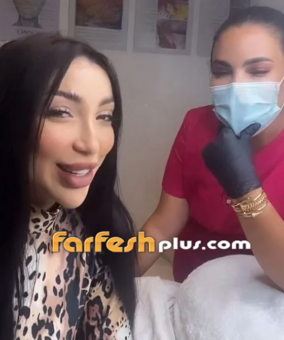 فيديو دنيا بطمة تحقن وجهها وتنفخ شفتيها وتتغزل بنفسها، والجمهور: مهووسة عمليات تجميل وشوهت شكلها! صورة رقم 5 فيديو دنيا بطمة تحقن وجهها وتنفخ شفتيها وتتغزل بنفسها، والجمهور: مهووسة عمليات تجميل وشوهت شكلها! صورة رقم 5