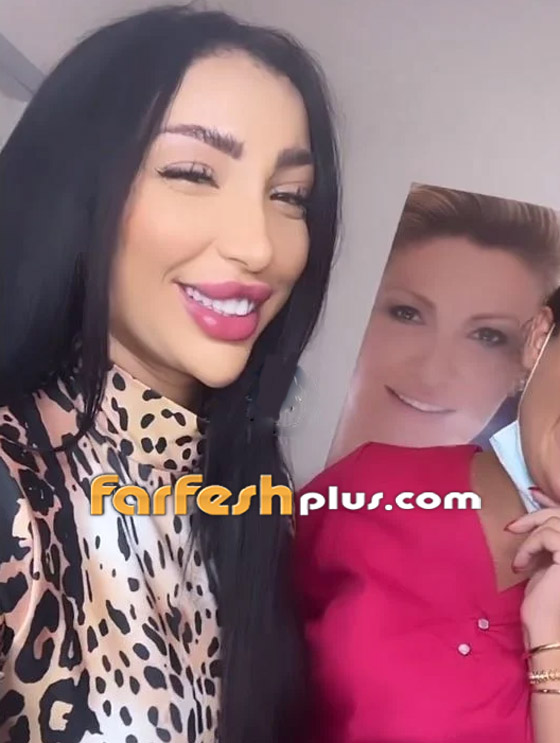 فيديو دنيا بطمة تحقن وجهها وتنفخ شفتيها وتتغزل بنفسها، والجمهور: مهووسة عمليات تجميل وشوهت شكلها! صورة رقم 6 فيديو دنيا بطمة تحقن وجهها وتنفخ شفتيها وتتغزل بنفسها، والجمهور: مهووسة عمليات تجميل وشوهت شكلها! صورة رقم 6