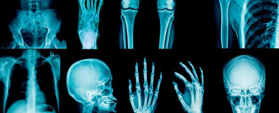 عائلة لا تشعر بالألم.. حالة عجيبة لأسرة مارسيلي الإيطالية صورة رقم 4