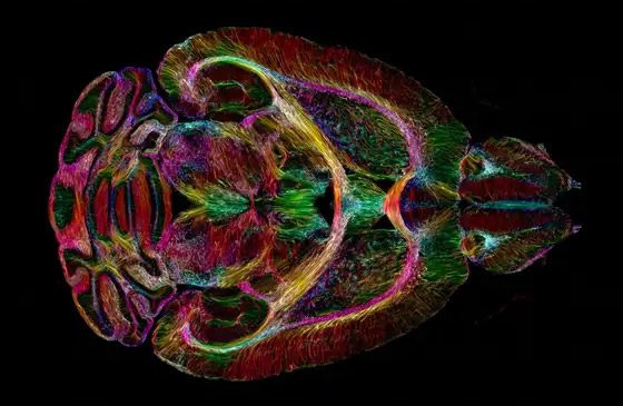 إنجاز كبير.. علماء يكشفون إنجاز كبير.. علماء يكشفون