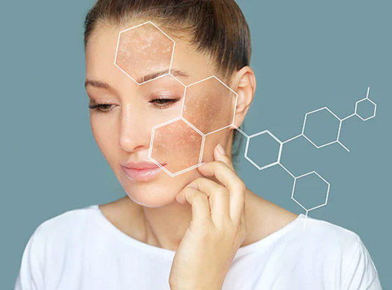 هذان المكونان هما الأفضل للتخلص من البقع الداكنة صورة رقم 1 هذان المكونان هما الأفضل للتخلص من البقع الداكنة صورة رقم 1