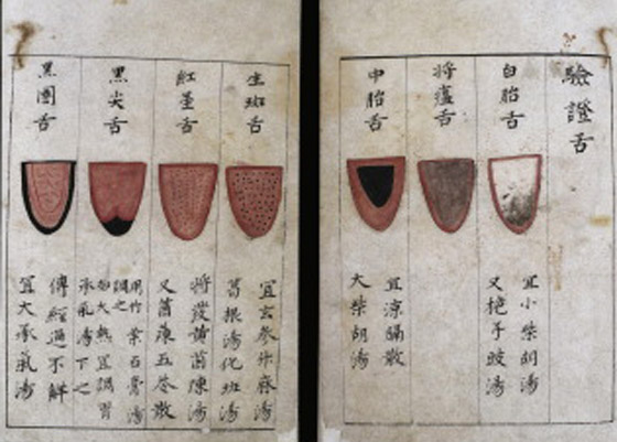 الذكاء الاصطناعي يدعم طريقة علاج صينية عبر فحص اللسان عمرها 2000 عام صورة رقم 3