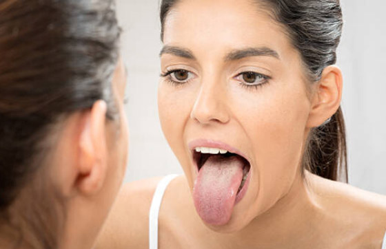 الذكاء الاصطناعي يدعم طريقة علاج صينية عبر فحص اللسان عمرها 2000 عام صورة رقم 4