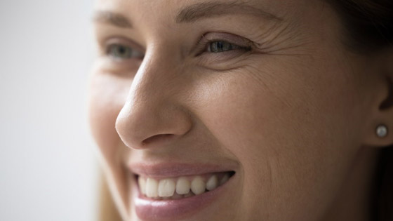 خطوات تساعدكِ على تجنب تجاعيد خطوط الابتسامة صورة رقم 3