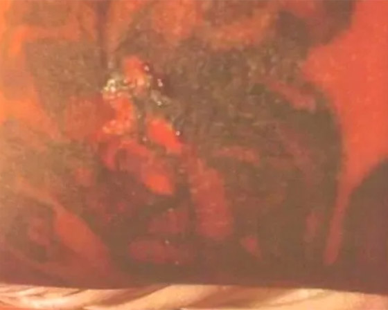 يرفع دعوى قضائية ضد شركة طيران بسبب فنجان قهوة صورة رقم 2