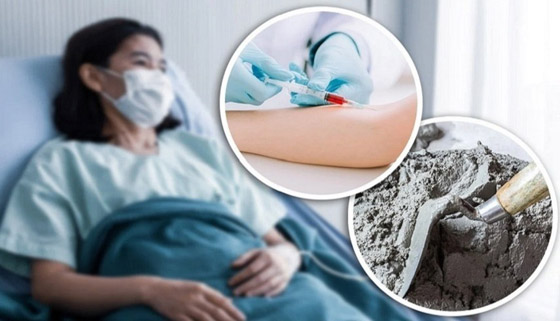 علاج غريب بالإسمنت لسرطان الثدي يتسبب بوفاة امرأة صورة رقم 1