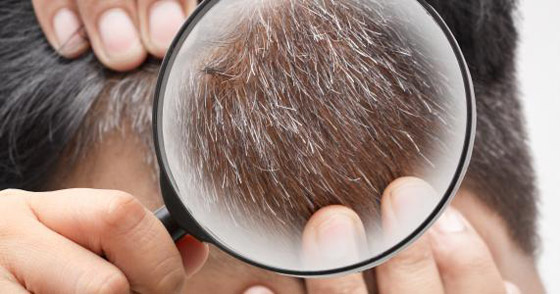 للوقاية من الشيب المبكر.. استوصوا بهذه الأطعمة الخارقة صورة رقم 12