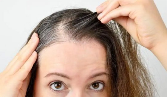 للوقاية من الشيب المبكر.. استوصوا بهذه الأطعمة الخارقة صورة رقم 13