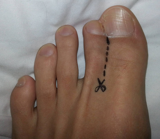 بالصور: 8 أشخاص تمكنوا من تجاوز مشكلاتهم بطرق ذكية ومبدعة صورة رقم 8