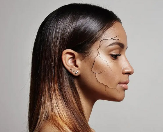 لهذه الأسباب تصبح البشرة جافة أو فاقدة للحيوية صورة رقم 1