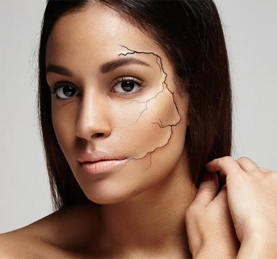 لهذه الأسباب تصبح البشرة جافة أو فاقدة للحيوية صورة رقم 3