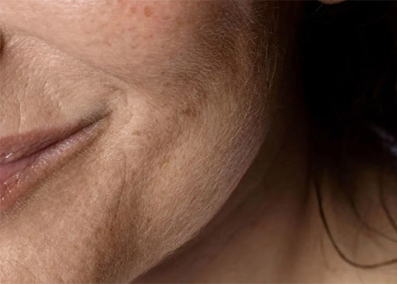 لهذه الأسباب تصبح البشرة جافة أو فاقدة للحيوية صورة رقم 2