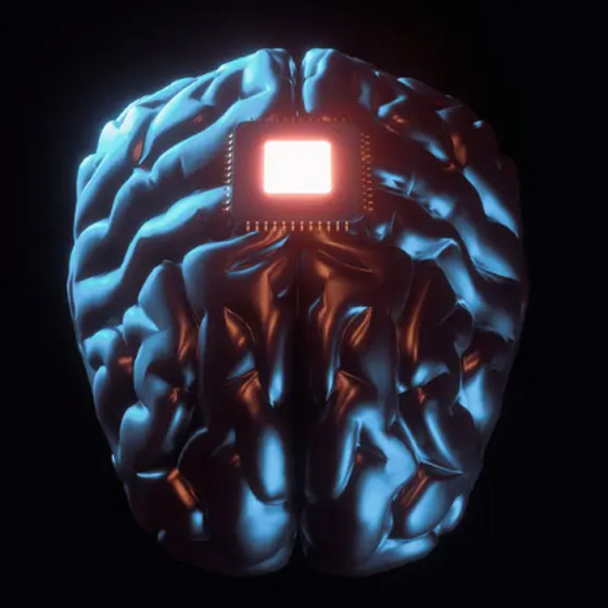 طوابير بالآلاف لتجربة شريحة إيلون ماسك للدماغ صورة رقم 2