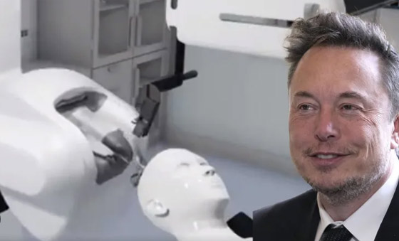 طوابير بالآلاف لتجربة شريحة إيلون ماسك للدماغ صورة رقم 5