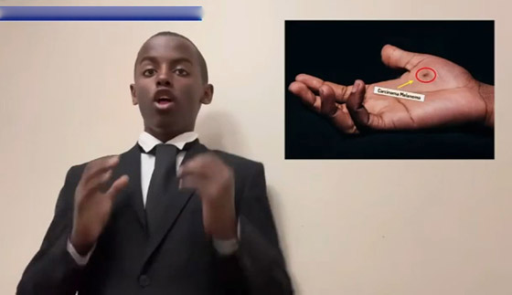 عالم أمريكي (14 عاما) يحصد جائزة لابتكاره صابونا يكافح أخطر أنواع السرطان صورة رقم 9