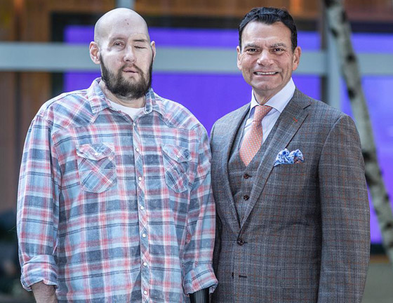 إنجاز طبي غير مسبوق.. تفاصيل أول عملية زراعة عين كاملة.. فيديو وصور صورة رقم 2