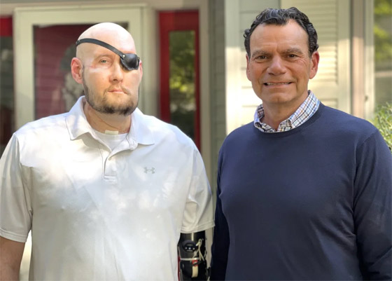 إنجاز طبي غير مسبوق.. تفاصيل أول عملية زراعة عين كاملة.. فيديو وصور صورة رقم 9