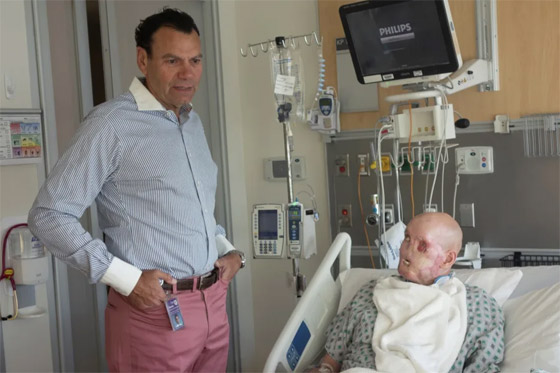 إنجاز طبي غير مسبوق.. تفاصيل أول عملية زراعة عين كاملة.. فيديو وصور صورة رقم 10