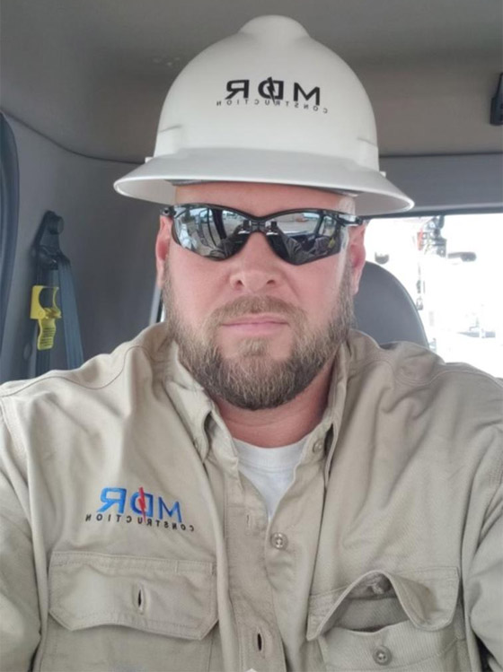 إنجاز طبي غير مسبوق.. تفاصيل أول عملية زراعة عين كاملة.. فيديو وصور صورة رقم 18