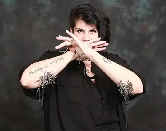 لديها قدرات خارقة.. سيدة تعيش بـ52 شريحة إلكترونية في جسدها (صور) صورة رقم 1