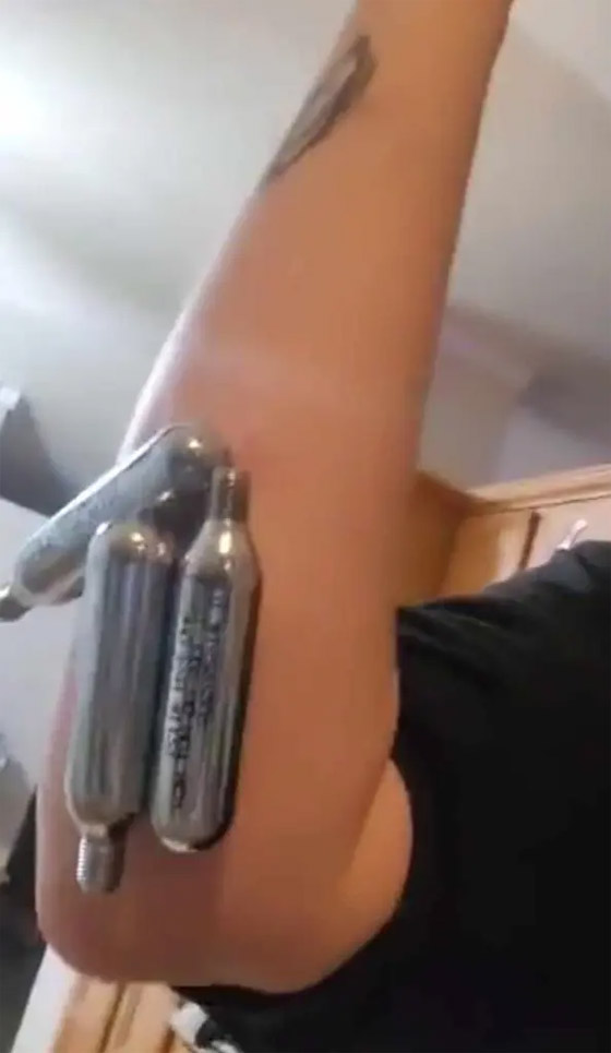 لديها قدرات خارقة.. سيدة تعيش بـ52 شريحة إلكترونية في جسدها (صور) صورة رقم 9