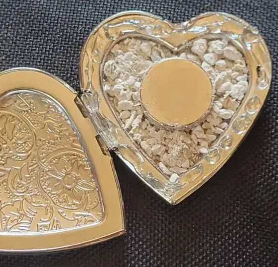 لديها قدرات خارقة.. سيدة تعيش بـ52 شريحة إلكترونية في جسدها (صور) صورة رقم 10