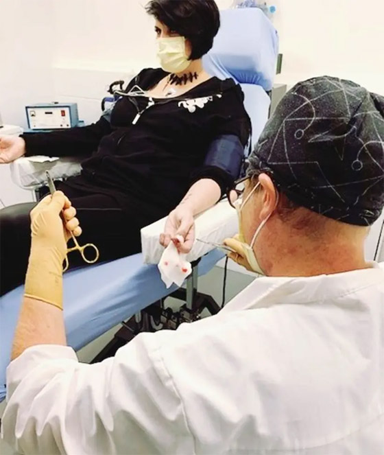 لديها قدرات خارقة.. سيدة تعيش بـ52 شريحة إلكترونية في جسدها (صور) صورة رقم 13