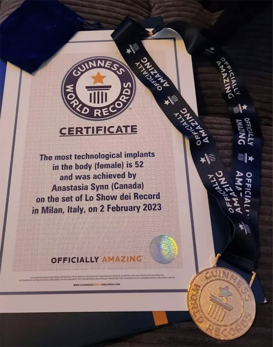 لديها قدرات خارقة.. سيدة تعيش بـ52 شريحة إلكترونية في جسدها (صور) صورة رقم 2