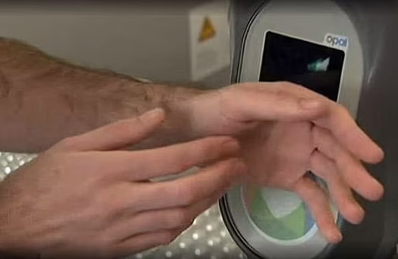 لديها قدرات خارقة.. سيدة تعيش بـ52 شريحة إلكترونية في جسدها (صور) صورة رقم 16