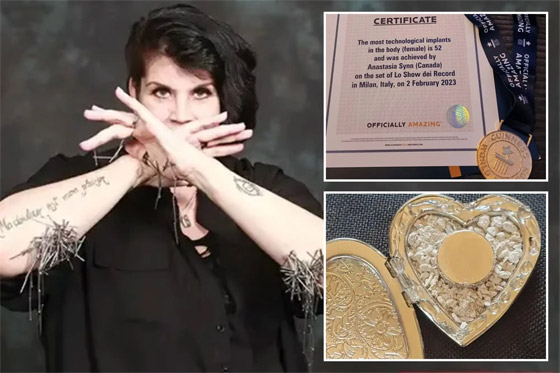 لديها قدرات خارقة.. سيدة تعيش بـ52 شريحة إلكترونية في جسدها (صور) صورة رقم 4