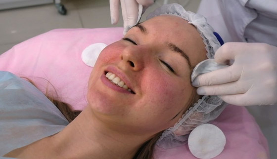 «الليزر الكربوني».. صيحة تجميلية تعزز جمال بشرتكِ صورة رقم 1